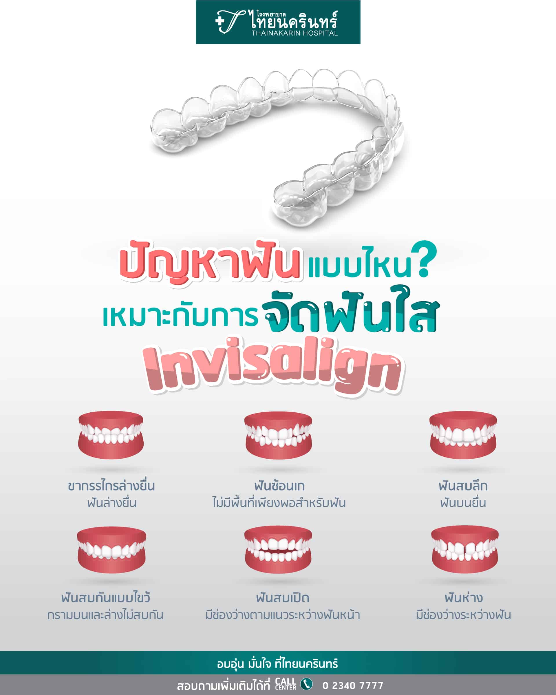 จัดฟันแบบใส Invisalign