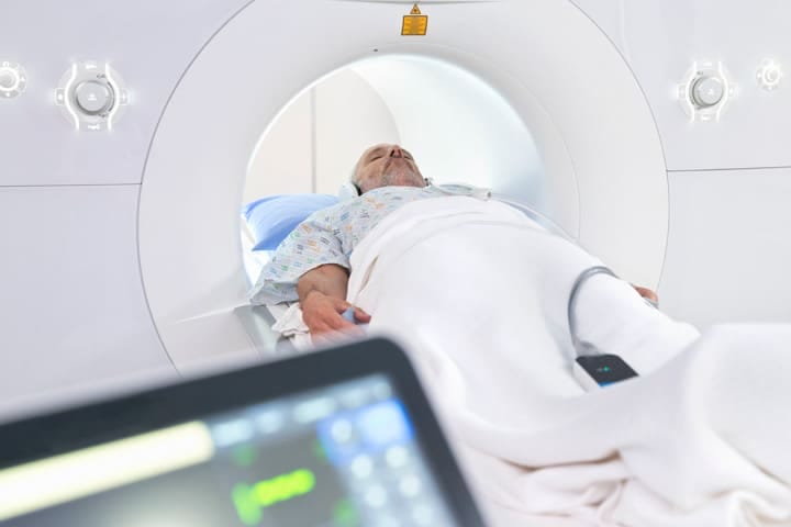 MRI กระดูกสันหลัง