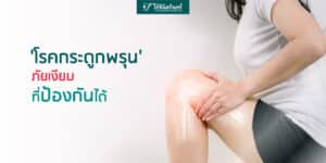 โรคกระดูกพรุน