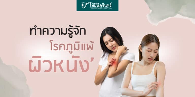 โรคภูมิแพ้ผิวหนัง