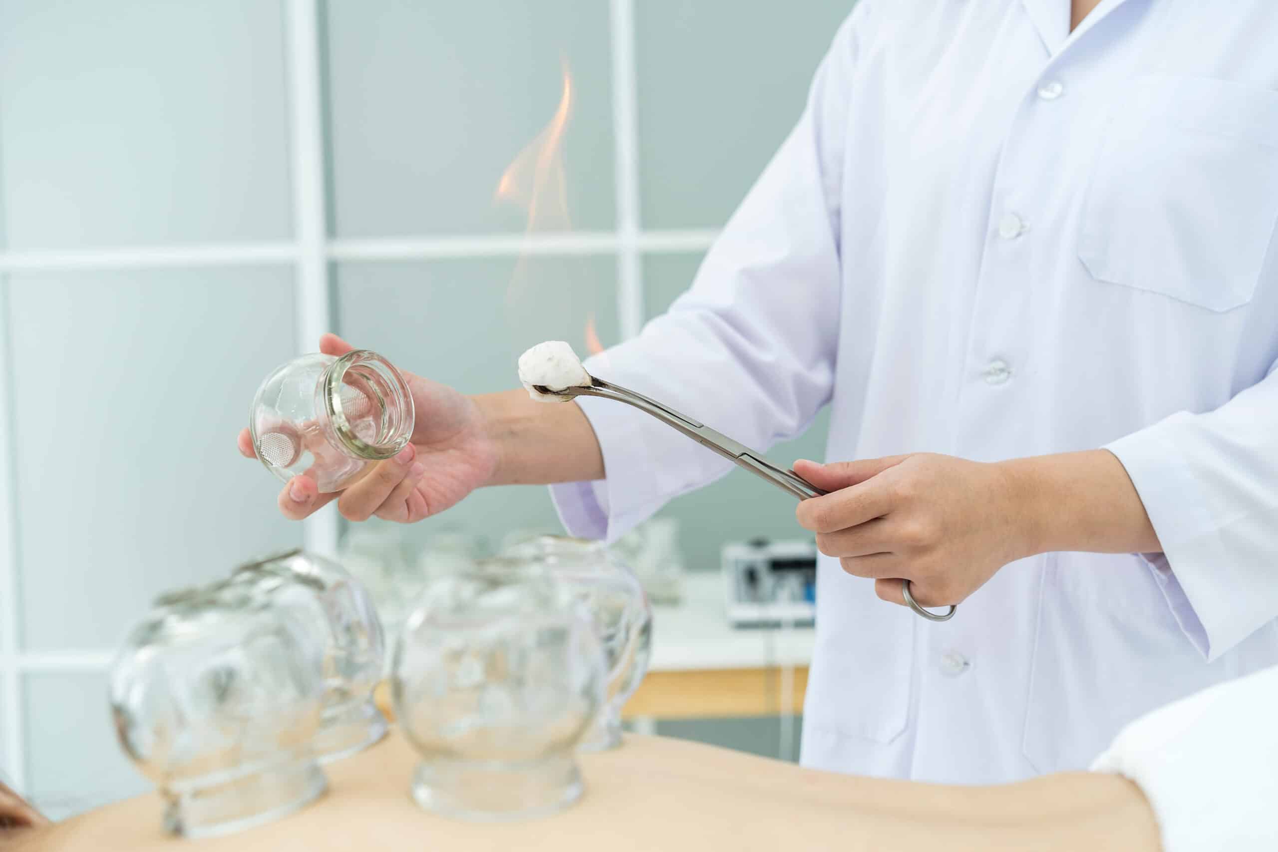 ครอบแก้ว Cupping Therapy