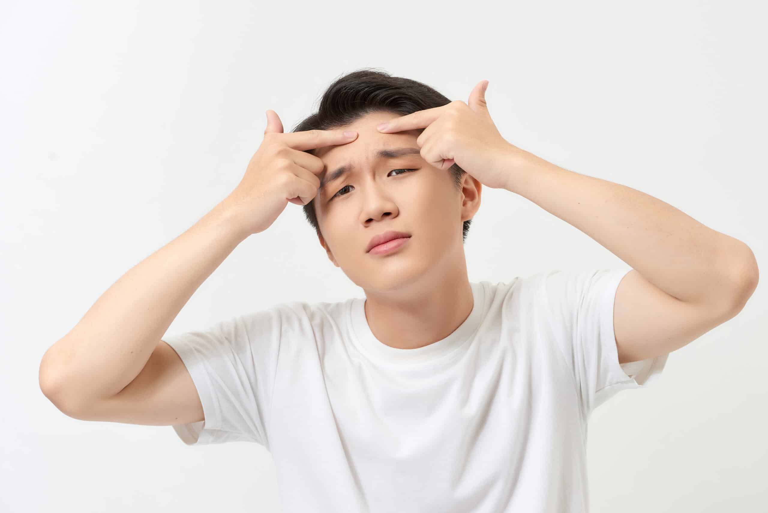 รักษาสิว