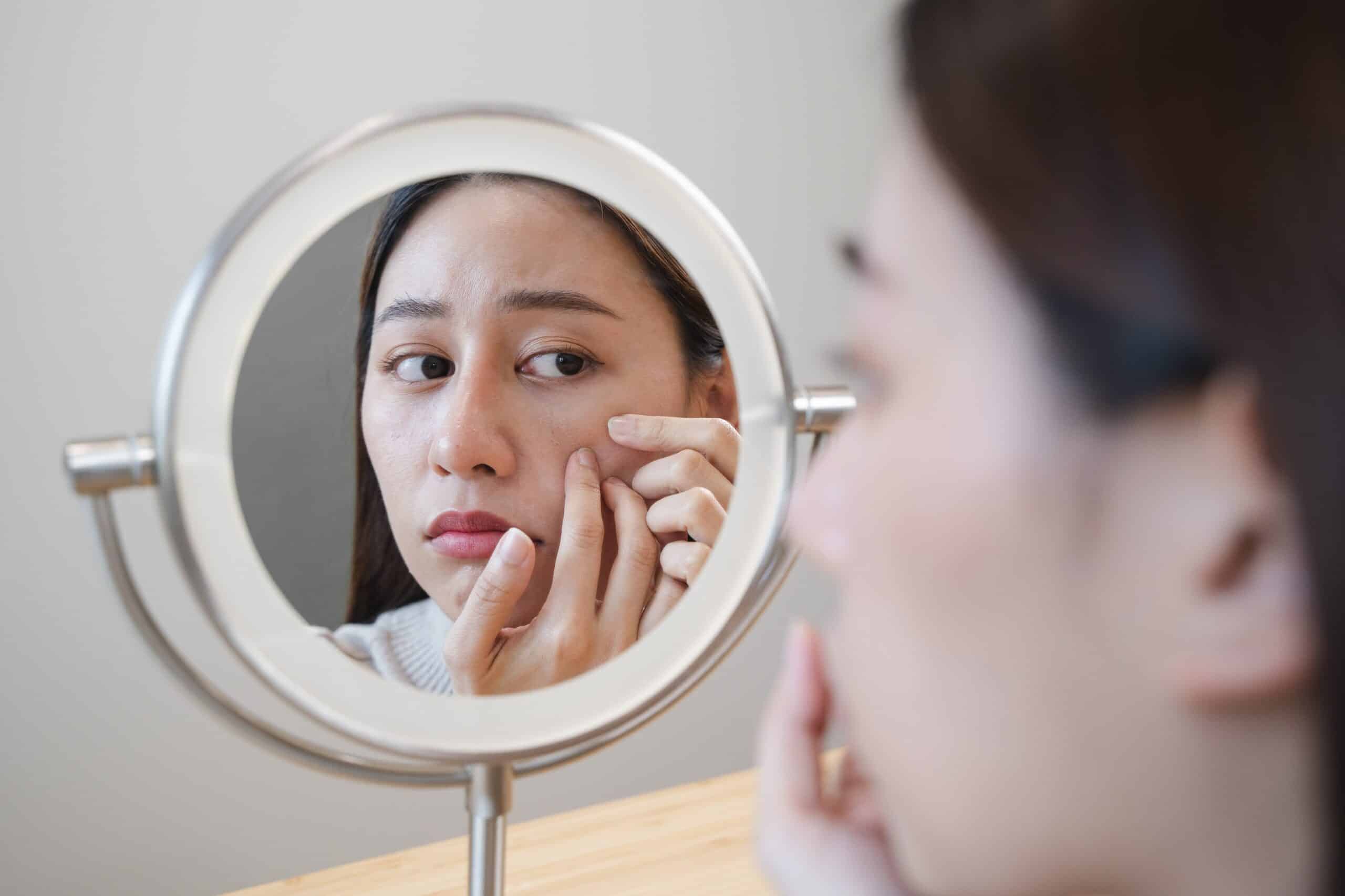 ความแก่ ริ้วรอย (Skin Aging) 