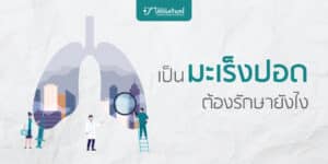 รักษามะเร็งปอด