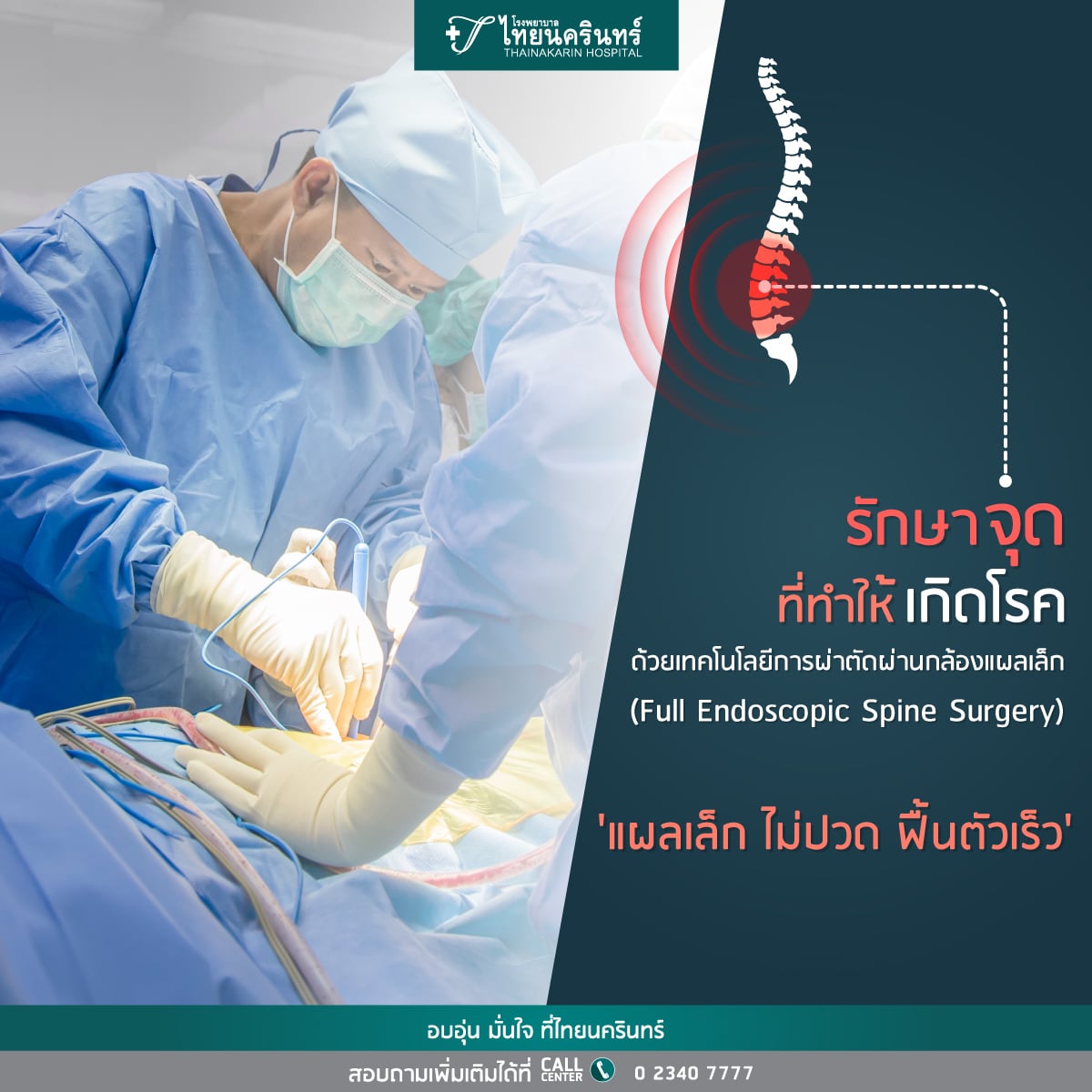 Full endoscopic spine surgery