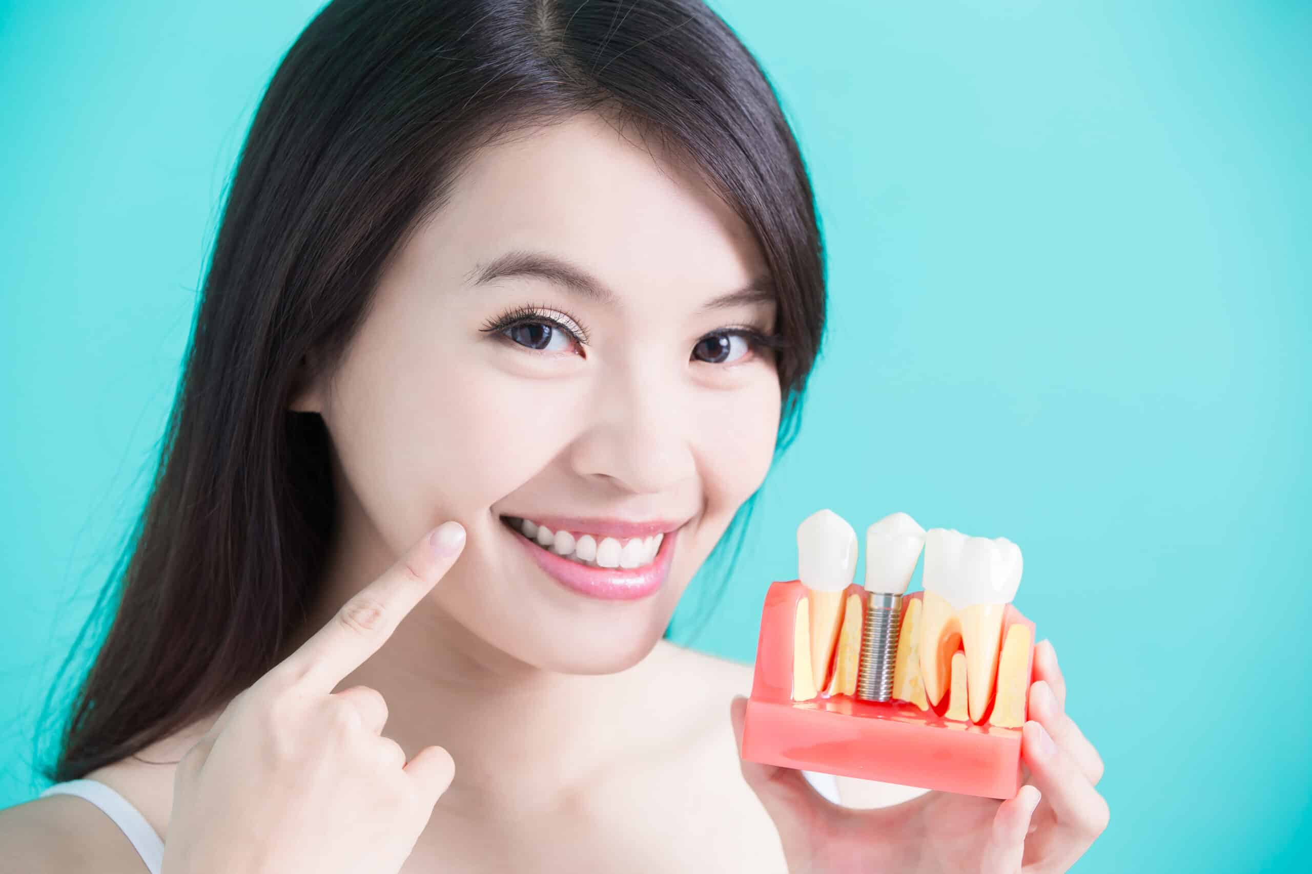 รากฟันเทียม (Dental Implant)