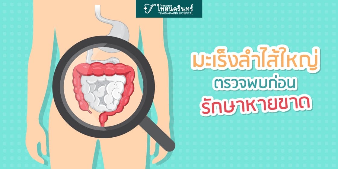 มะเร็งลําไส้ใหญ่อาการระยะแรก อาการมะเร็งลำไส้แต่ละระยะ
