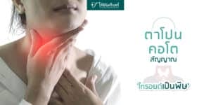 ไทรอยด์เป็นพิษ