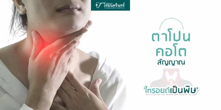 ไทรอยด์เป็นพิษ