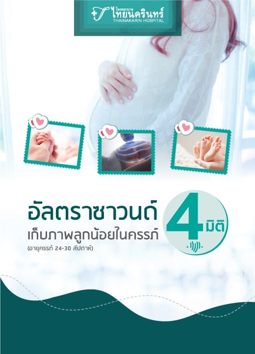 อัลตราซาวนด์ 4 มิติ