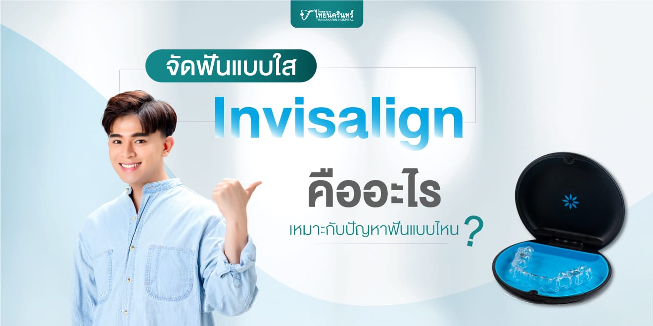 จัดฟันแบบใส Invisalign คืออะไร เหมาะกับปัญหาฟันแบบไหน?