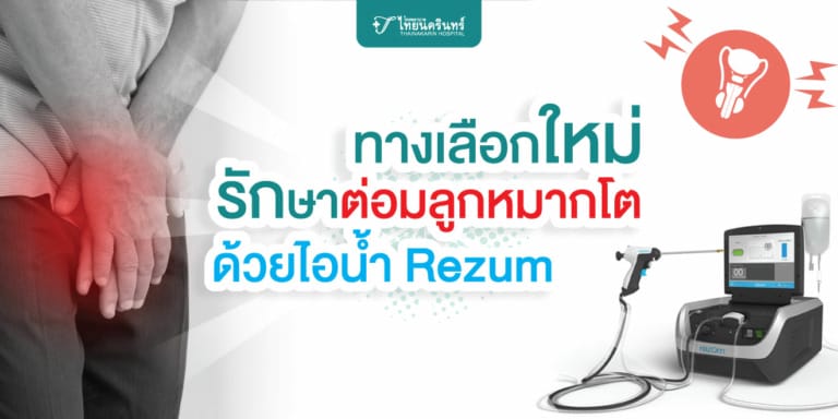 รักษาต่อมลูกหมากโต ด้วยไอน้ำ Rezum