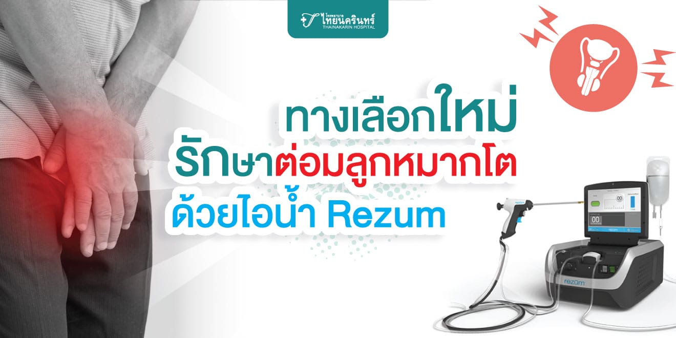 รักษาต่อมลูกหมากโต ด้วยไอน้ำ Rezum