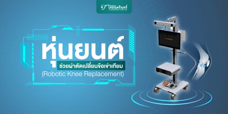 หุ่นยนต์ช่วยผ่าตัด เปลี่ยนข้อเข่าเทียม (Robotic Knee Replacement)