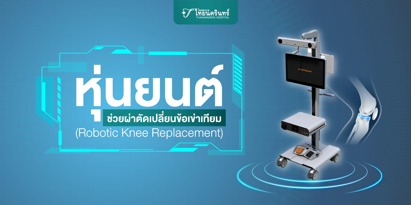 หุ่นยนต์ช่วยผ่าตัด เปลี่ยนข้อเข่าเทียม (Robotic Knee Replacement)