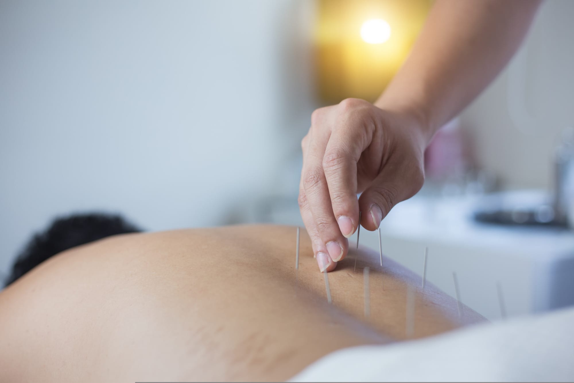 ฝังเข็ม รักษา ปวดคอ บ่า ไหล่ ศาสตร์แพทย์แผนจีน